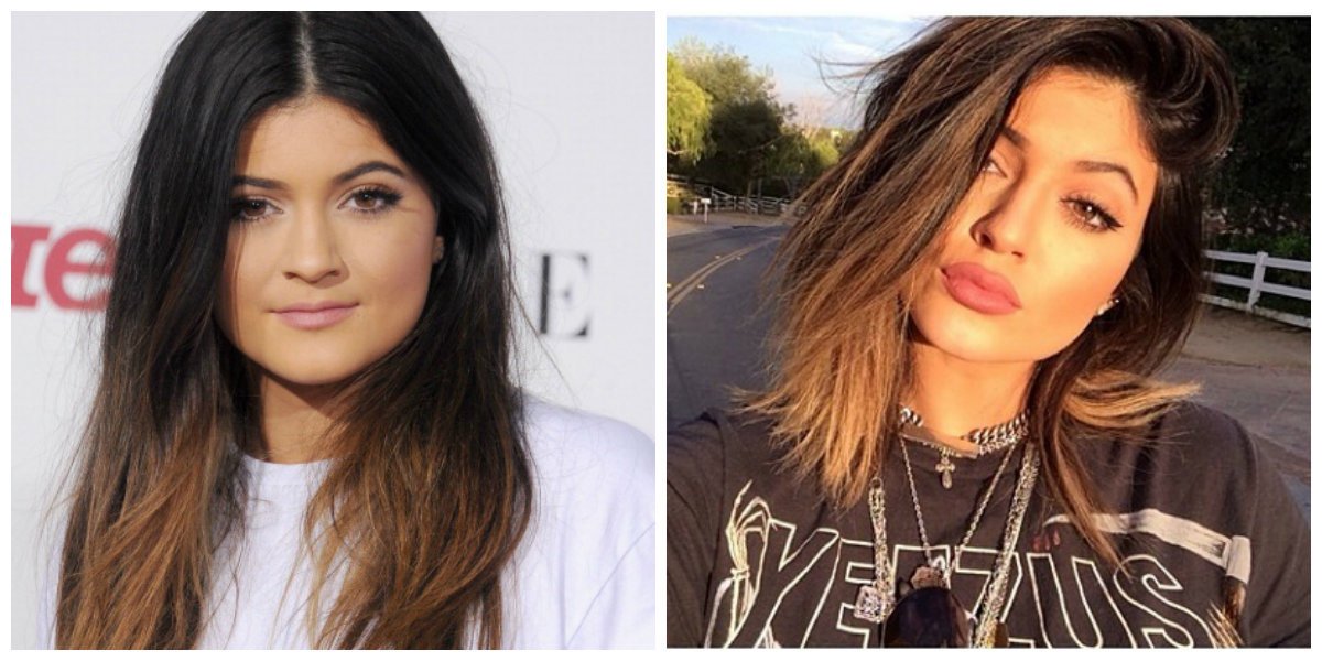Did Kylie Jenner Get Plastic Surgery?