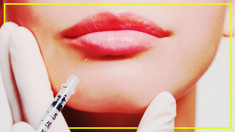botox in the lips