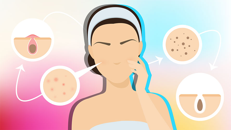 The Stages of a Dark Spot