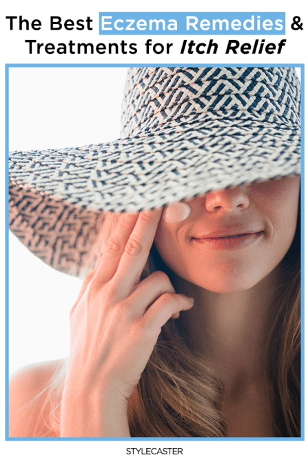 STYLECASTER | eczema remedies | eczema treatment | eczema relief | eczema cream
