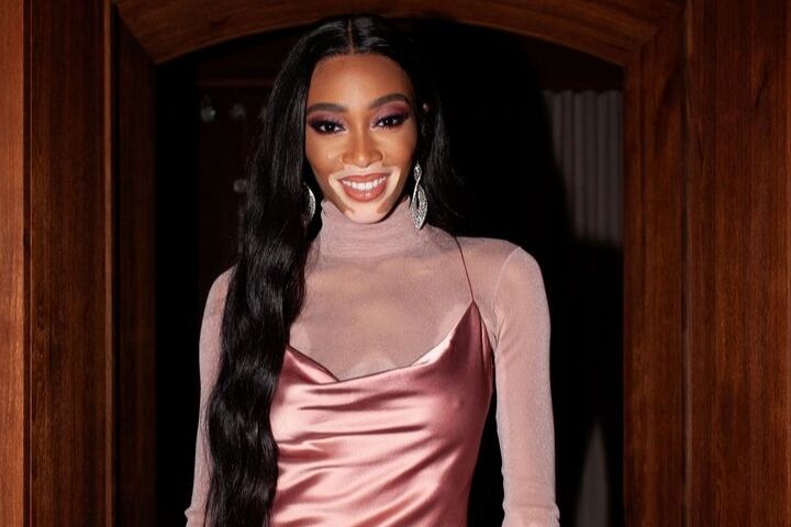winnie harlow visine trick