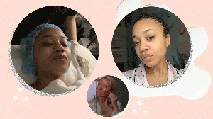 pca-chemical-peel-review