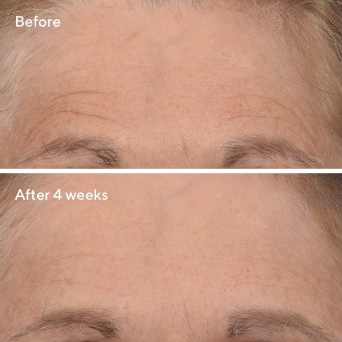 murad retinol results