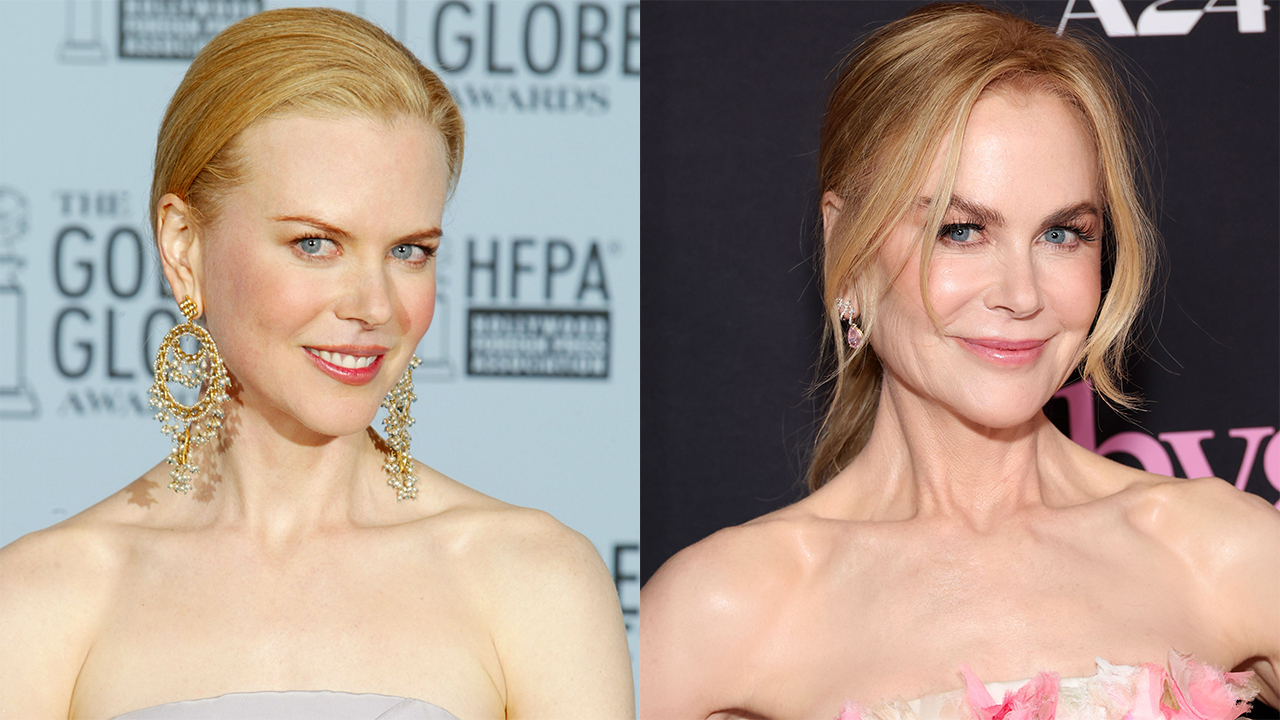 Nicole Kidman Plastic Surgery